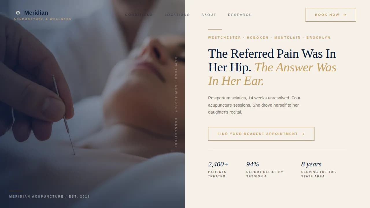 Acupoint — Proven Acupuncture Clinic Landing Page Template