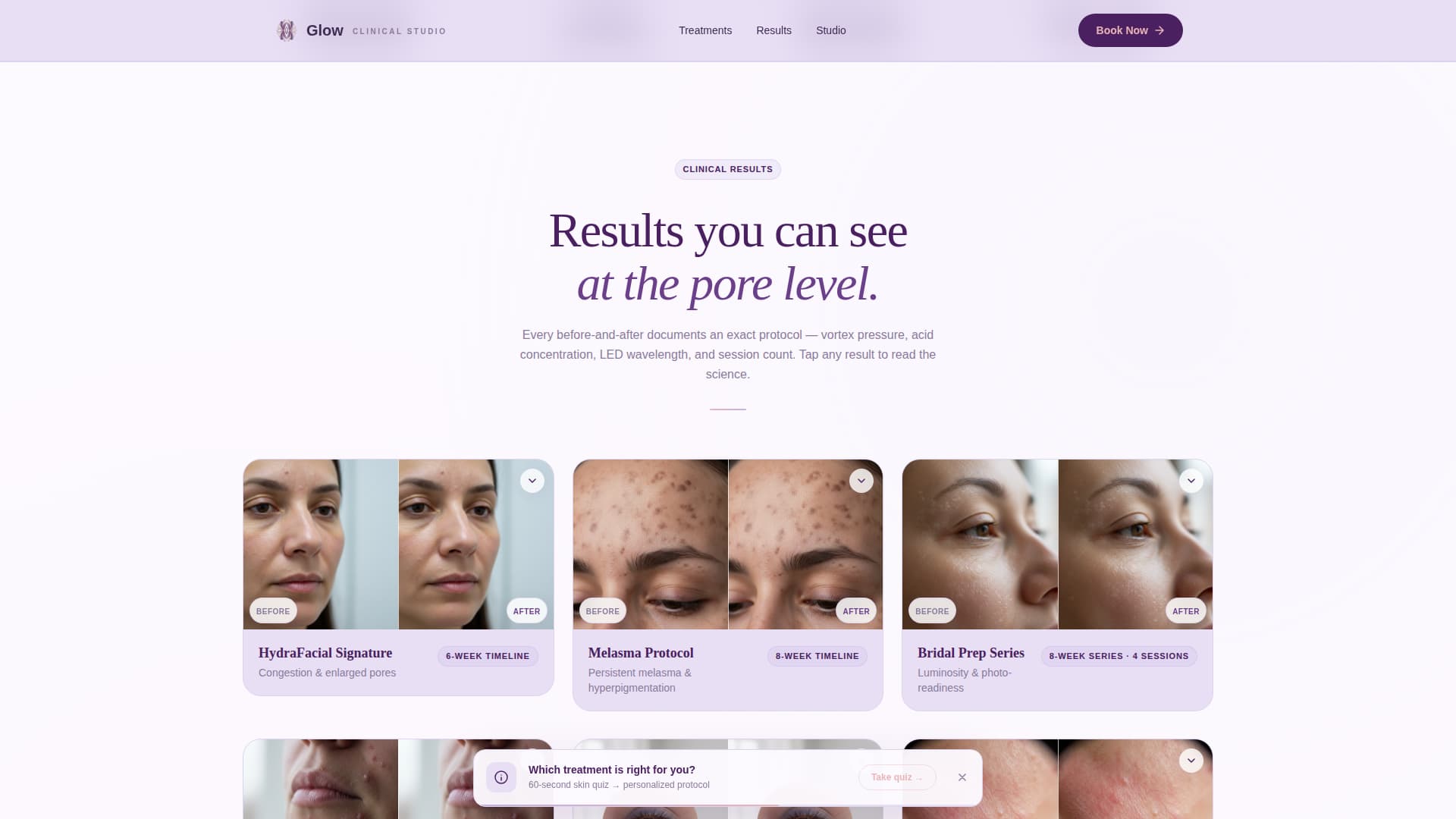 Glow — Luxury Anti-Aging Landing Page Template