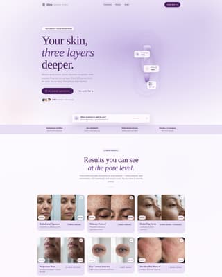 Glow — Luxury Anti-Aging Landing Page Template