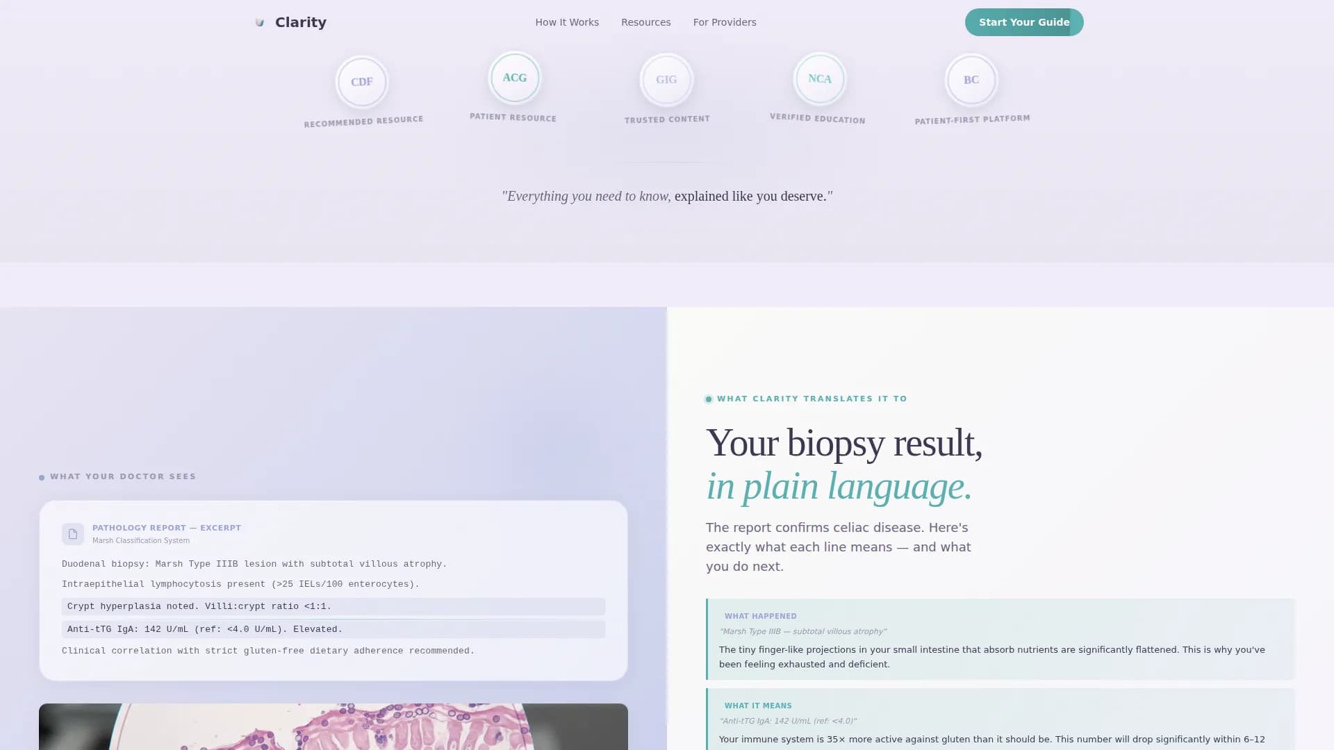 Celiac Disease Care Education Website Template