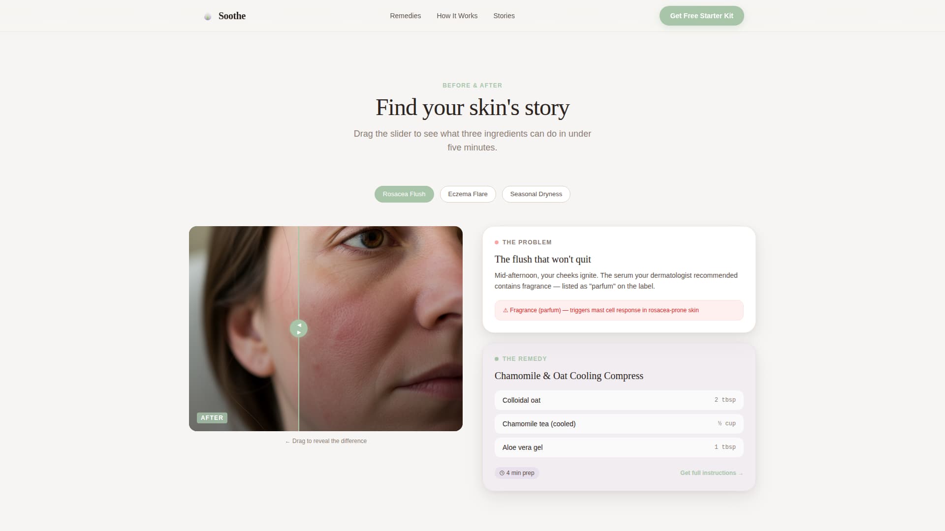 Sensitive Skin Beauty Professional Website Template