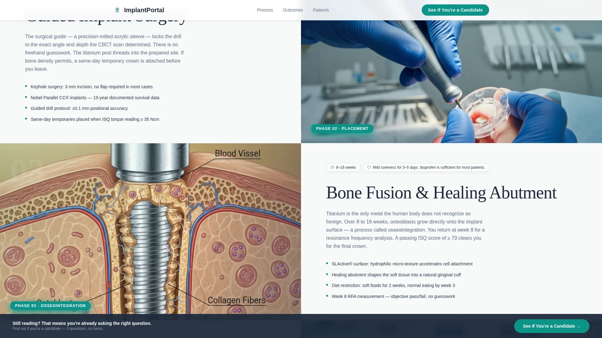 Advanced Implant Dentist Appointment Booking Website Template