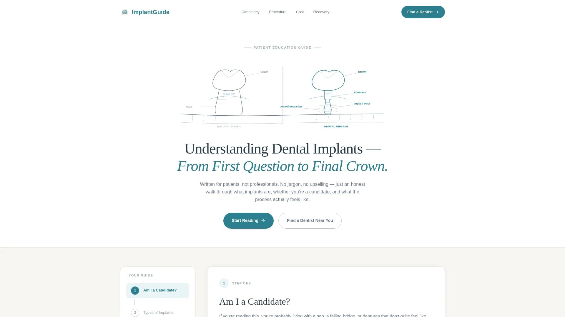 Implant Dentist Provider Directory Website Template